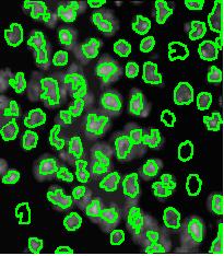 Image:Drosophila nuclei_47_3.JPG