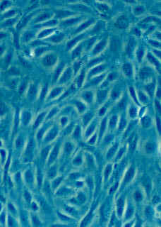 Image:Human_Umbilical_Vein_Endothelial_Cells_(HUVEC).jpg