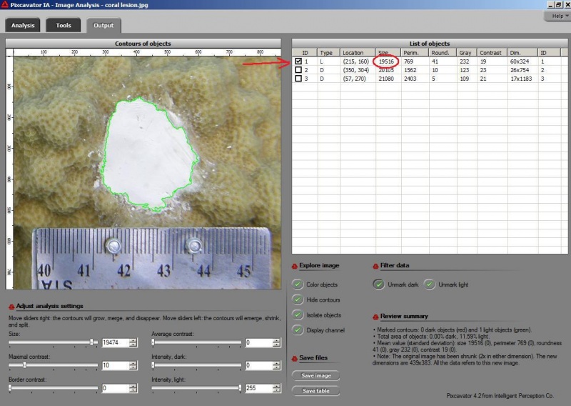 lesion captured inside green contour, measurements on the right