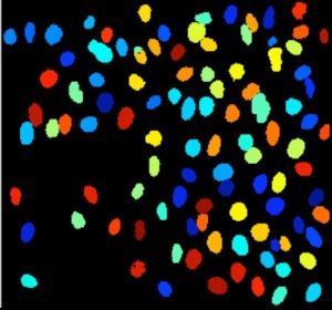 Drosophila cellprofiler.JPG