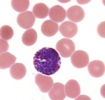 Basophil  (a type of white blood cell)