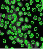 Drosophila nuclei, captured