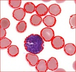 Basophil (purple) captured along with the rest